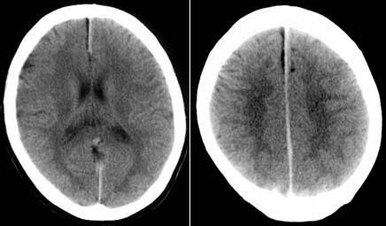 どのような症状がありますか?